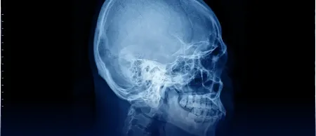 Facial Growth & Skeletal Structure