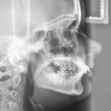 Growth-Guided Orthodontics