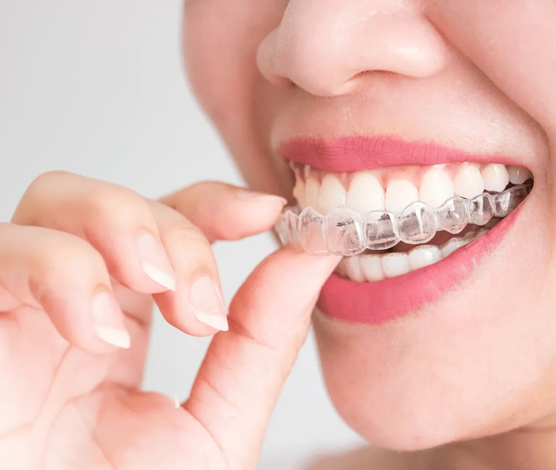 Smiling patient placing a clear, metal-free dental appliance against their teeth