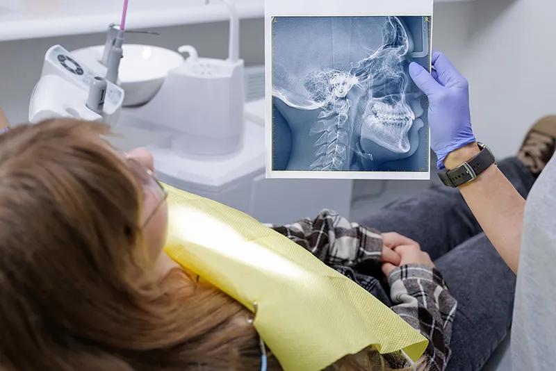 MARPE treatment with Sokolowski photo placeholder