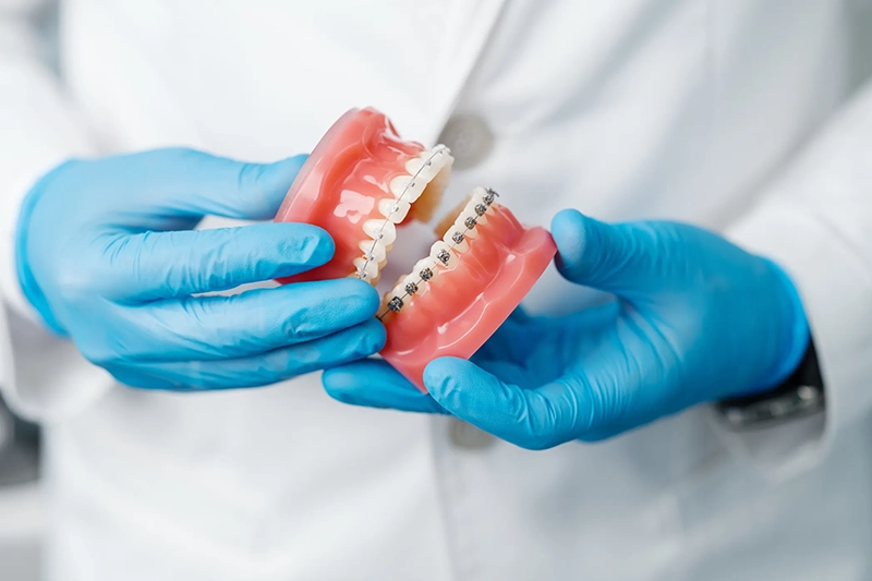 Dentist holding an orthodontic model with a clear aligner and braces