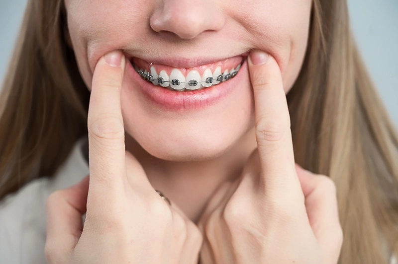 Phase one orthodontics at Daghlian Pediatric Dentistry & Sokolowski Orthodontics