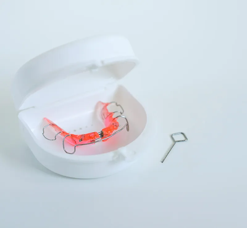 Expansion in phase one orthodontics photo placeholder